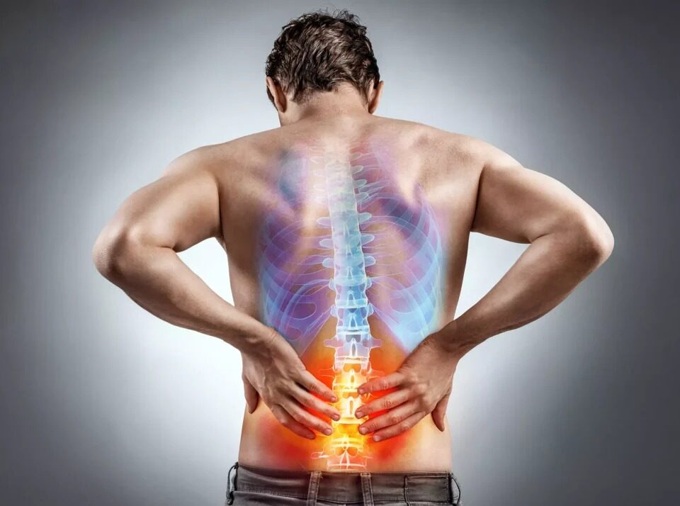 Diagram showing common causes of lower back pain including herniated disc, muscle strain, and spinal stenosis