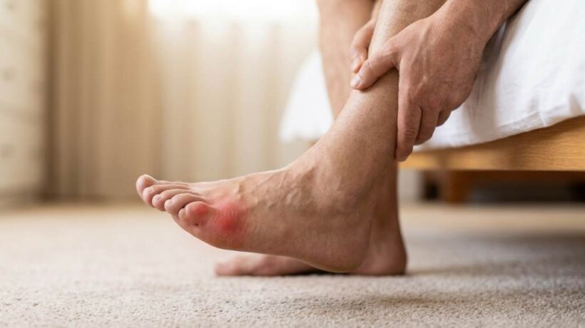 How to Walk Comfortably With Gout in Miami, FL